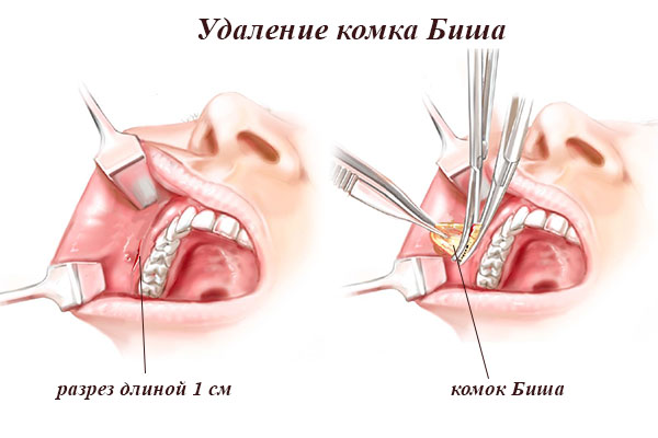 Создаем утонченные черты лица: какая операция в этом поможет?